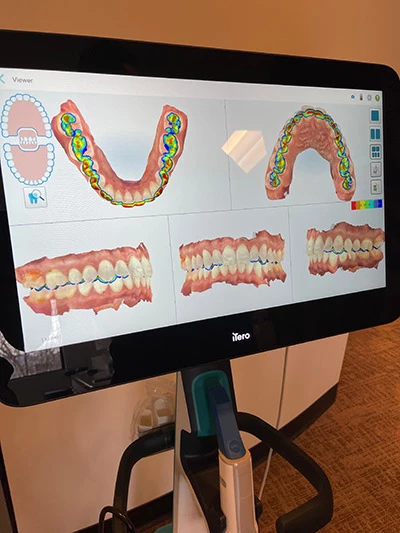 Boulder Smile Design uses the latest dental technologies